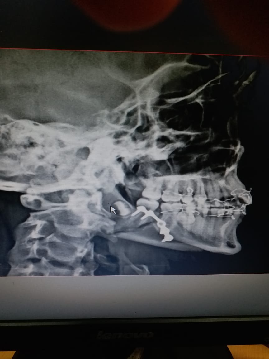 Quisque venenatis mi at